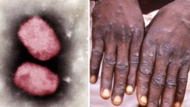 Monkeypox threat in India: विदेश से लौटे युवक में मंकी पॉक्स के लक्षण पाए गए, आइसोलेशन में रखा गया